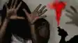 Girl Acid Attack: प्यार का जुनून बना हैवानियत, शादी तय होने से नाराज़ आशिक ने सोती युवती पर फेंका एसिड