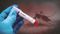 Dengue Surge in Patna 18 Cases in 5 Days Hotspots Identified