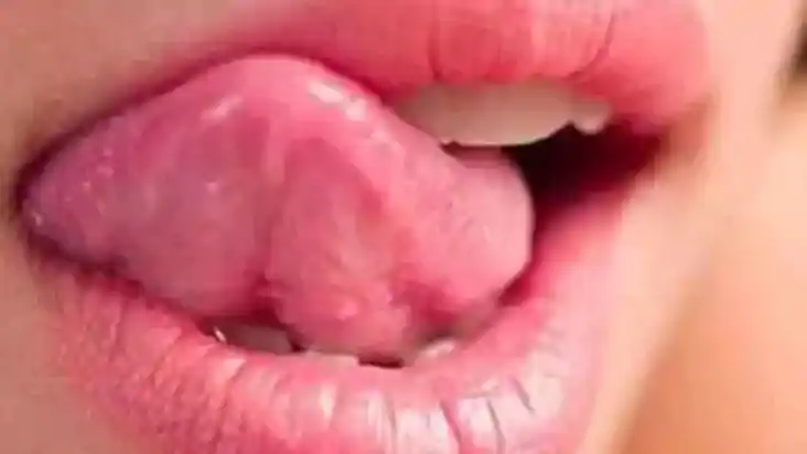 tongue color 