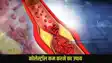 How To Reduce Cholesterol