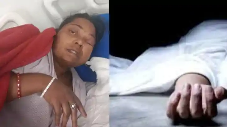 भागलपुर एसिड कांड: सनकी पति ने पत्नी को तेजाब से झुलसाया, फि