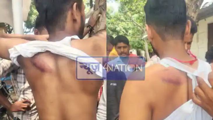 Andar Nagar Panchayat Supervisor Assault Siwan