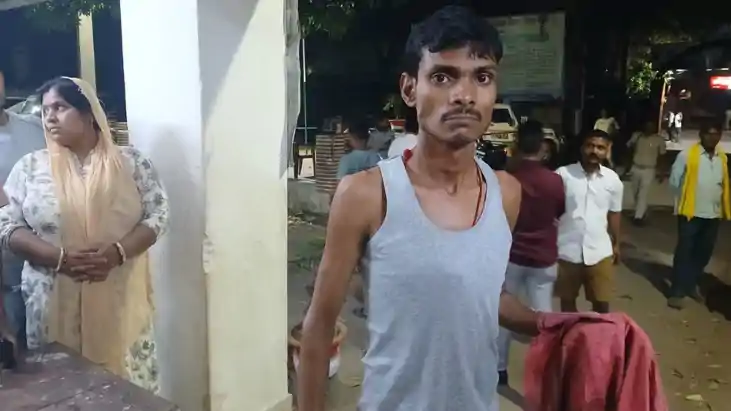 एसिड अटैक 