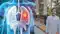 7 Minute Lung Cancer Immunotherapy Launched in India