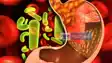 Food Poisoning in Gayaji