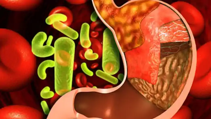 Food Poisoning in Gayaji
