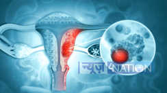 uterine cancer