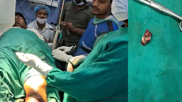 Bihar Crime : भोजपुर में हर्ष फायरिंग का कहर, बीमार भाई की द