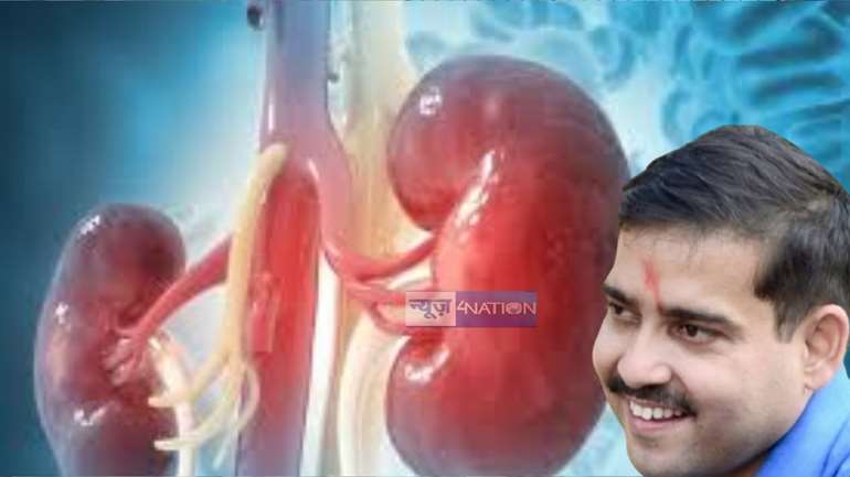 Kidney Transplant in Patna