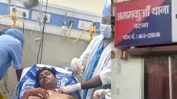 Patna Teacher Shot Twice During Robbery Bid in Area