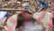 Patna Newborn  Body Found in Garbage