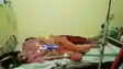 Kasturba School 12 Students Hospitalized Due to Food Poisoning