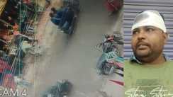 'नशेड़ियों' का खूनी खेल: फल दुकानदार पर हसुआ से जानलेवा हमला, CCTV में कैद हुई गुंडई; एक गिरफ्तार