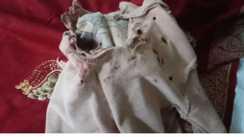 Katihar Child Injured in Acid Attack After Playground Clash