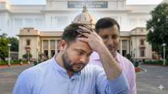 तेजस्वी को 'अपनों' ने दिया घाव: ढाका से मनिहारी तक बगावत की इनसाइड स्टोरी, क्या दिल्ली से सेट हुआ था गेम?