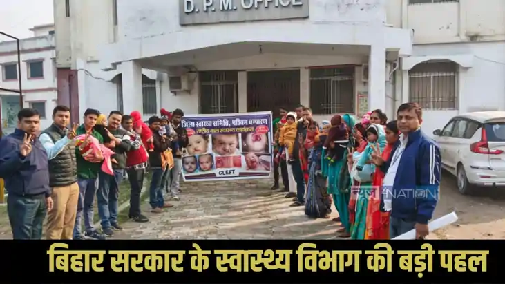 West Champaran Health Department: प. चंपारण के 22 होंठ-तालु 