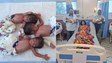 triplets birth in Simri Bakhtiyarpur