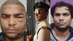 Kanpur Hair Transplant Case का पटना कनेक्शन:9 मार्च को हेयर ट्रांसप्लांट करवाया 11 मार्च को सिपाही की हुई दर्दनाक मौत,जाँच अब भी जारी है मकतुल का भाई दारोगा है