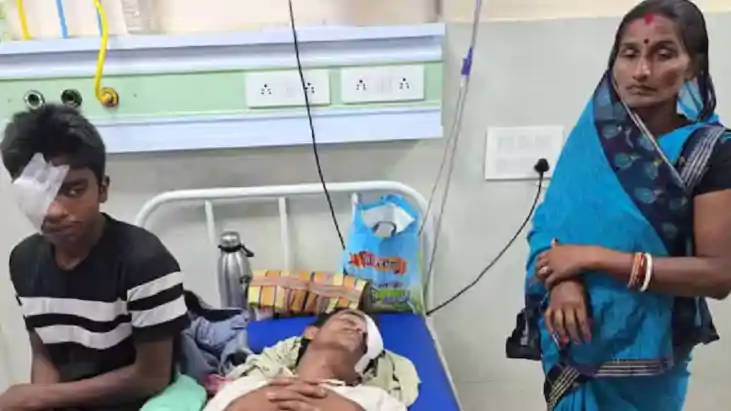 Araria Acid Attack:अररिया में तेजाब से हमला, 10 युवक झुलसे, 