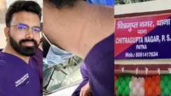 chain snatching in Patna