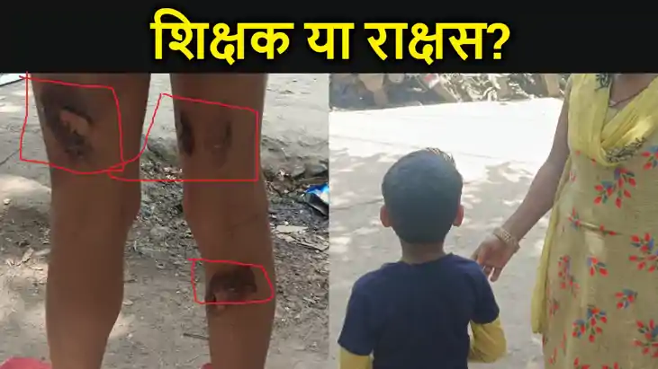 शिक्षक या राक्षस? पटना में टीचर बना हैवान,  6 और 8 साल के छा
