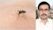 Patna dengue sting