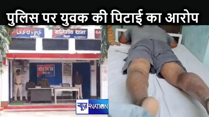 हाजीपुर पुलिस पर लगा बर्बरतापूर्वक मारपीट करने का आरोप, पीड़ हाजीपुर पुलिस पर लगा बर्बरतापूर्वक मारपीट करने का आरोप, पीड़