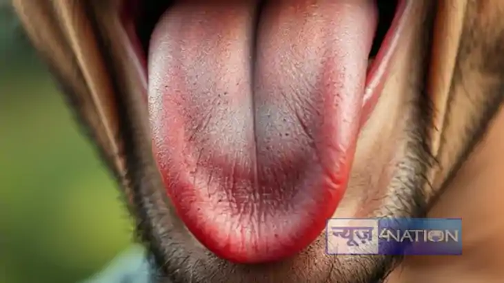 Rajasthan wife cuts husband tongue: पत्नी के गुस्से का शिकार