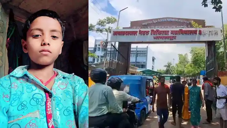 Bihar News : बांका में खौलते तेल की कढ़ाही में गिरा 11 साल क