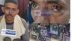 Patna Police ankh phodwa incident if you dont believe it then see it