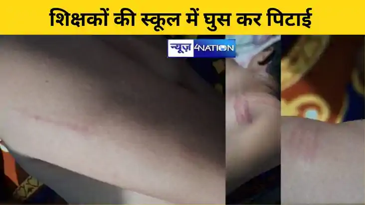 Bihar Teacher News:  शिक्षकों की स्कूल में घुस कर लाठी-डंडे 