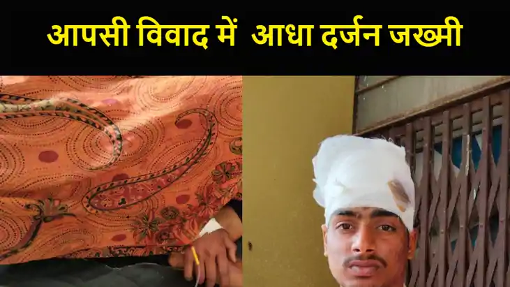 मुजफ्फरपुर में आपसी विवाद में जमकर हुई मारपीट, आधा दर्जन लोग मुजफ्फरपुर में आपसी विवाद में जमकर हुई मारपीट, आधा दर्जन लोग
