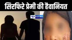 प्रेमी ने प्रेमिका के गाल पर लिखा दिया अपना नाम, लोहे को रॉड को लाइटर से किया गर्म फिर दाग दिया...