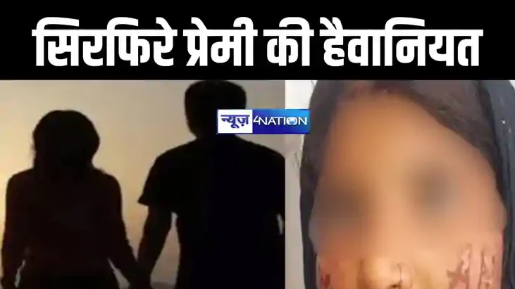 प्रेमी ने प्रेमिका के गाल पर लिखा दिया अपना नाम, लोहे को रॉड प्रेमी ने प्रेमिका के गाल पर लिखा दिया अपना नाम, लोहे को रॉड