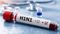 Two H1N1 Cases Confirmed in Patna