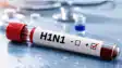 Two H1N1 Cases Confirmed in Patna