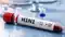 Two H1N1 Cases Confirmed in Patna