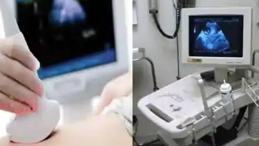 Illegal Ultrasound Clinics Surge in Bihar