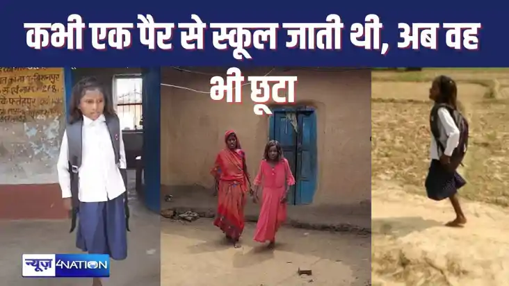एक पैर पर कूदते हुए स्कूल जानेवाली सीमा फिर से तकलीफ में, कद