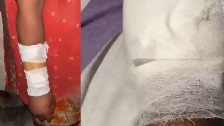 Motihari Hospital Faces Heat Over Cardboard Plaster Video