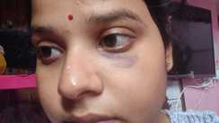 Darbhanga Another Anisha climbed the altar of dowry