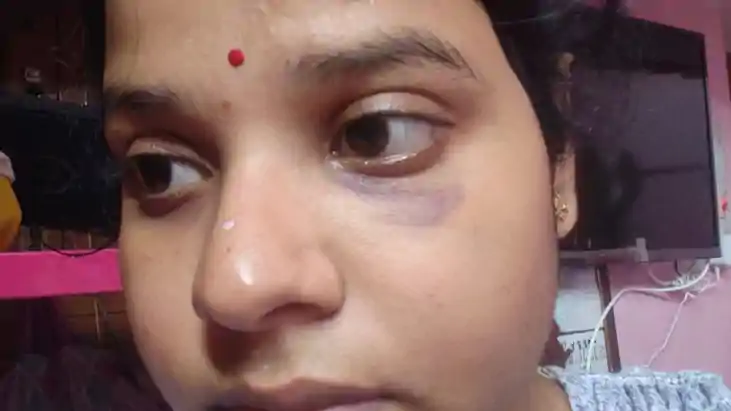 Darbhanga Another Anisha climbed the altar of dowry