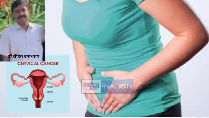 CERVICAL CANCER