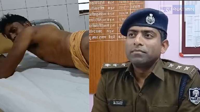 'महाराज ने पुलिसवालों को बना दिया है निरंकुश राजा!' युवक पर बरसी बिहार पुलिस की बर्बरता, RJD ने सोशल मीडिया पर पीड़ित की तस्वीर जारी कर नीतीश कुमार पर किया कटाक्ष